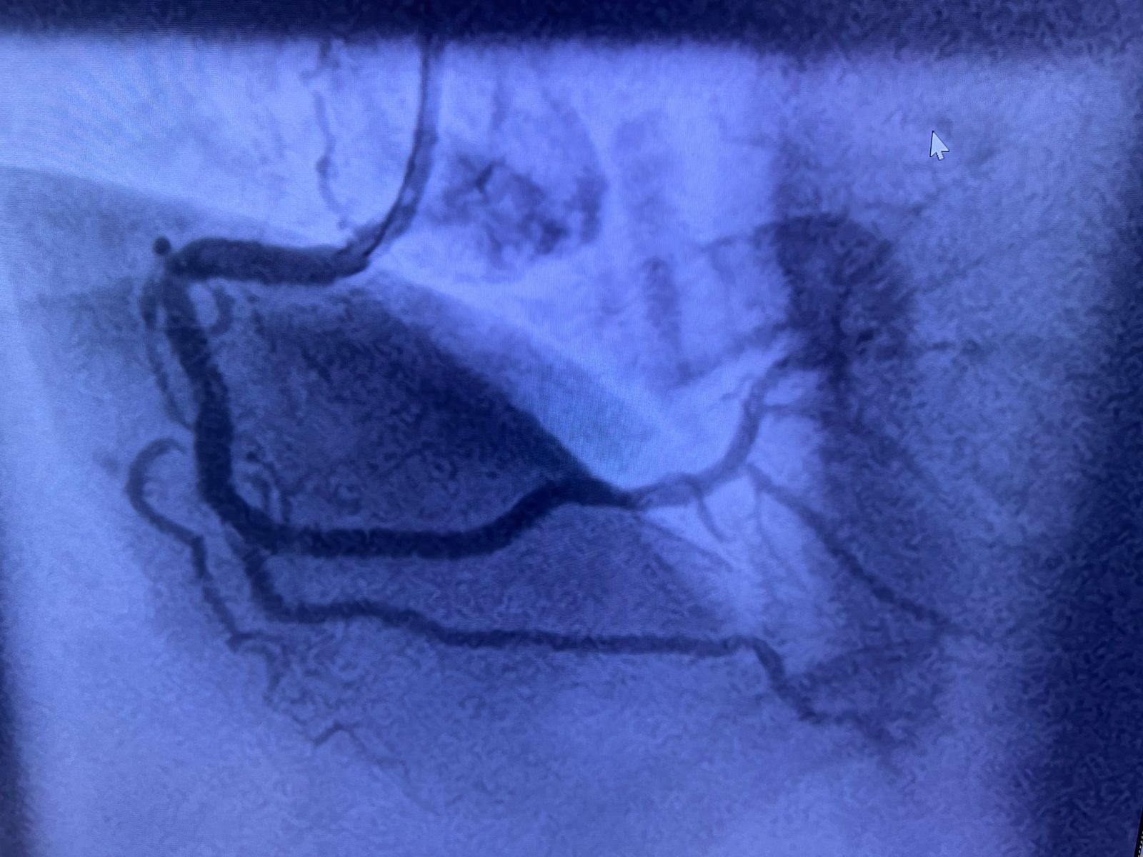 Medical Angiogram Image 5